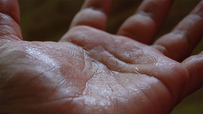 What Is Excessive Sweating a Sign Of?